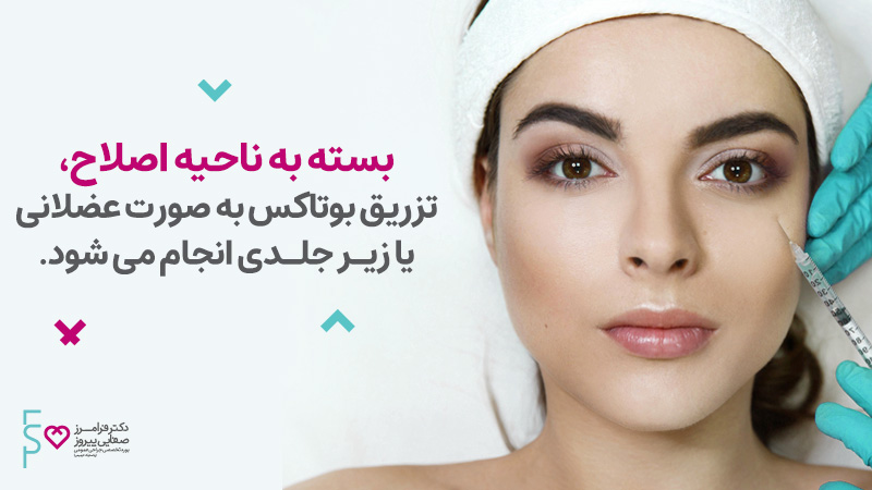 نحوه تزریق بوتاکس صورت